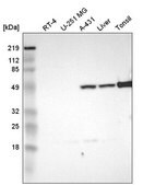 Anti-TYMP antibody produced in rabbit Prestige Antibodies&#174; Powered by Atlas Antibodies, affinity isolated antibody