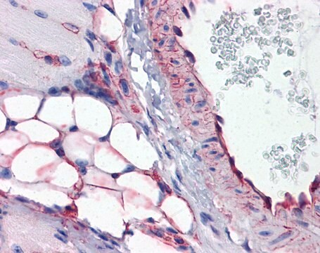 Anti-CAVIN1 antibody produced in rabbit affinity isolated antibody