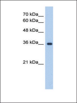 Anti-ELOVL7 antibody produced in rabbit IgG fraction of antiserum