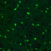 Anti-FH antibody produced in rabbit affinity isolated antibody, buffered aqueous glycerol solution, ab1