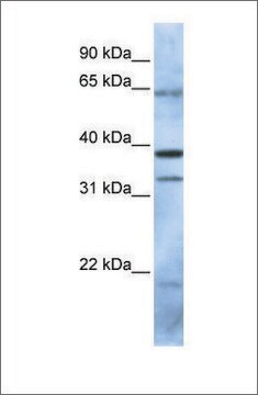 Anti-PCGF5 antibody produced in rabbit affinity isolated antibody