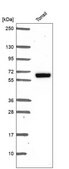 Anti-Esr2 Antibody Produced In Rabbit Prestige Antibodies&#174; Powered by Atlas Antibodies, affinity isolated antibody, buffered aqueous glycerol solution