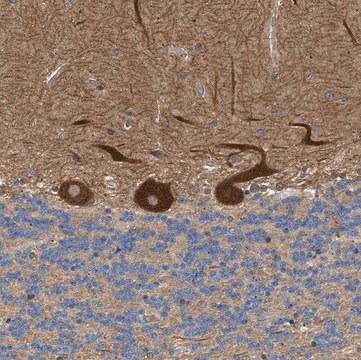 Anti-PPM1B antibody produced in rabbit Prestige Antibodies&#174; Powered by Atlas Antibodies, affinity isolated antibody, buffered aqueous glycerol solution