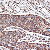 Anti-NDUFB8 antibody produced in rabbit