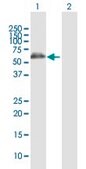 Anti-ALDH4A1 antibody produced in rabbit purified immunoglobulin, buffered aqueous solution