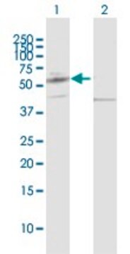 Anti-PPAT antibody produced in rabbit purified immunoglobulin, buffered aqueous solution