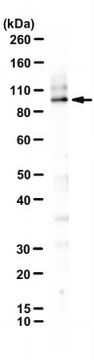 Anti-RHBDF2 Antibody, clone RHF2B 11H7