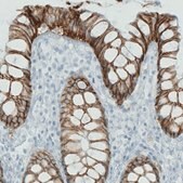 Monoclonal Anti-CA12 antibody produced in mouse Prestige Antibodies&#174; Powered by Atlas Antibodies, clone CL0278, purified immunoglobulin, buffered aqueous glycerol solution