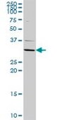 Anti-ATP4B antibody produced in rabbit purified immunoglobulin, buffered aqueous solution