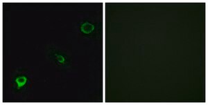 Anti-TYK2 antibody produced in rabbit affinity isolated antibody