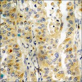 Anti-phospho-HDAC8 (pSer39) antibody produced in rabbit affinity isolated antibody