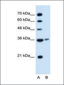 Anti-ARG1 (AB2) antibody produced in rabbit IgG fraction of antiserum