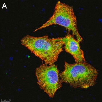 Anti-SLC10A1 Antibody, clone 1B12 ZooMAb&#174; Rabbit Monoclonal recombinant, expressed in HEK 293 cells