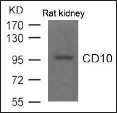 Anti-CD10 antibody produced in rabbit affinity isolated antibody