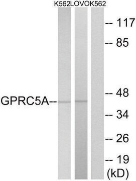 Anti-GPRC5A antibody produced in rabbit affinity isolated antibody