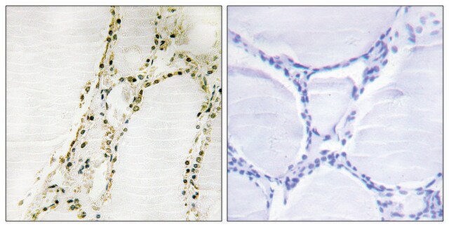 Anti-S6K-&#945;2 antibody produced in rabbit affinity isolated antibody