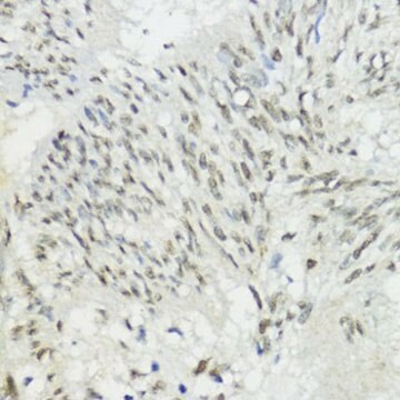 Anti- ZEB1 antibody produced in rabbit