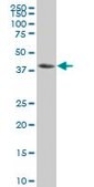Monoclonal Anti-NFKBIB antibody produced in mouse clone 3E11, purified immunoglobulin, buffered aqueous solution