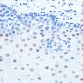 Anti-CDK9 antibody produced in rabbit