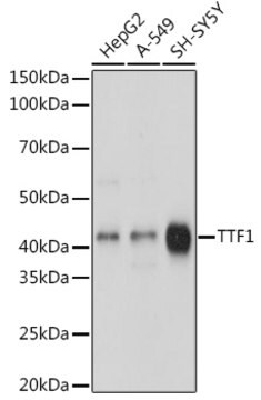 Anti-NKX2-1 Antibody, clone 3O2N3, Rabbit Monoclonal