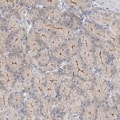 Anti-ADRB2 antibody produced in rabbit Prestige Antibodies&#174; Powered by Atlas Antibodies, affinity isolated antibody, buffered aqueous glycerol solution