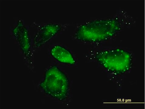 Anti-SQSTM1 antibody produced in mouse purified immunoglobulin, buffered aqueous solution