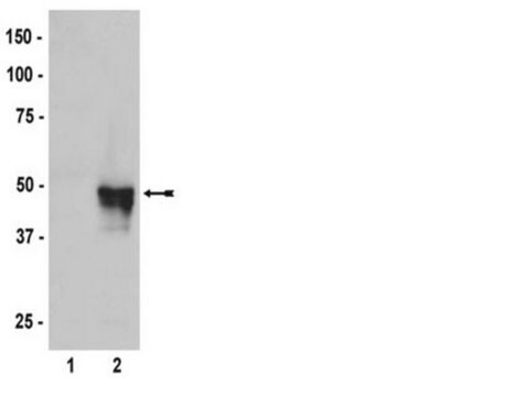 Anti-HA Tag Antibody Upstate&#174;, from mouse