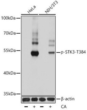 Anti-Phospho-STK3-T384 antibody produced in rabbit