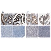 Anti-PGR antibody produced in rabbit Ab2, Prestige Antibodies&#174; Powered by Atlas Antibodies, affinity isolated antibody, buffered aqueous glycerol solution