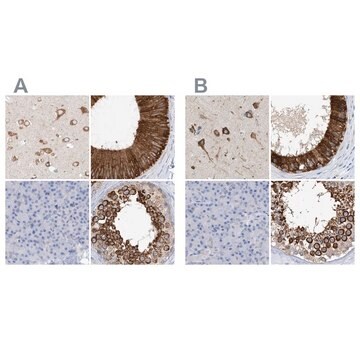 Anti-RCN2 antibody produced in rabbit Prestige Antibodies&#174; Powered by Atlas Antibodies, affinity isolated antibody, buffered aqueous glycerol solution