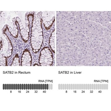 Monoclonal Anti-SATB2 antibody produced in mouse Prestige Antibodies&#174; Powered by Atlas Antibodies, clone CL0320, purified immunoglobulin, buffered aqueous glycerol solution