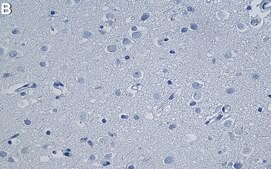 Anti-P2RY12 Antibody, clone 2C12 ZooMAb&#174; Rabbit Monoclonal recombinant, expressed in HEK 293 cells