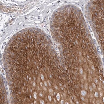 Anti-TECR antibody produced in rabbit Prestige Antibodies&#174; Powered by Atlas Antibodies, affinity isolated antibody, buffered aqueous glycerol solution