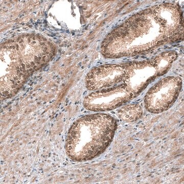 Monoclonal Anti-SMAD4 antibody produced in mouse Prestige Antibodies&#174; Powered by Atlas Antibodies, clone CL9774, purified immunoglobulin, buffered aqueous glycerol solution