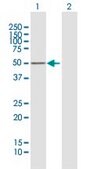 Anti-PRKAR1B antibody produced in mouse purified immunoglobulin, buffered aqueous solution