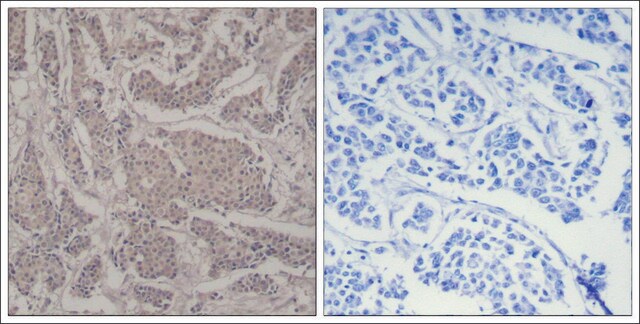 Anti-SMAD3 (Ab-425) antibody produced in rabbit affinity isolated antibody
