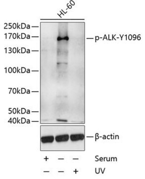 Anti-Phospho-ALK-Y1096 antibody produced in rabbit