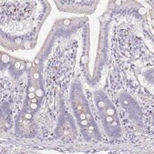 Anti-SRD5A1 antibody produced in rabbit Prestige Antibodies&#174; Powered by Atlas Antibodies, affinity isolated antibody, buffered aqueous glycerol solution