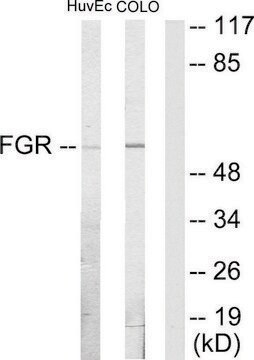 Anti-FGR antibody produced in rabbit affinity isolated antibody