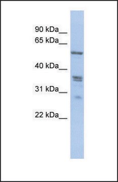 Anti-SLC38A2, (N-terminal) antibody produced in rabbit affinity isolated antibody