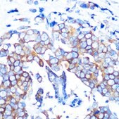 Anti-HDAC6 Antibody, clone 9V1W2, Rabbit Monoclonal