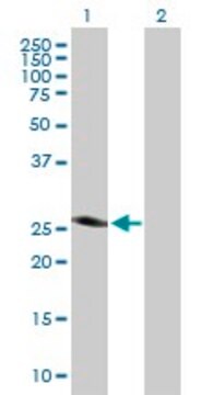 Anti-SPINT2 antibody produced in mouse purified immunoglobulin, buffered aqueous solution