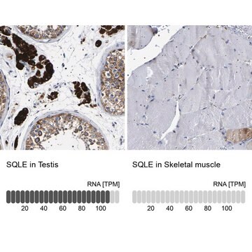 Anti-SQLE antibody produced in rabbit Prestige Antibodies&#174; Powered by Atlas Antibodies, affinity isolated antibody, buffered aqueous glycerol solution