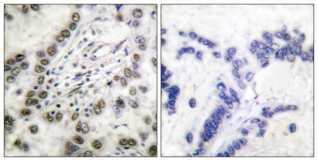 Anti-CBP antibody produced in rabbit affinity isolated antibody