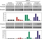 Monoclonal Anti-&#946;-Actin antibody produced in mouse clone AC-15, ascites fluid