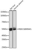 Anti-PEDF/SERPINF1 Antibody, clone 4H0C5, Rabbit Monoclonal