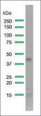 Anti-SMA antibody, Rabbit monoclonal recombinant, expressed in proprietary host, clone SP171, affinity isolated antibody