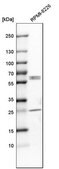 Anti-CASP8 antibody produced in rabbit Prestige Antibodies&#174; Powered by Atlas Antibodies, affinity isolated antibody, buffered aqueous glycerol solution