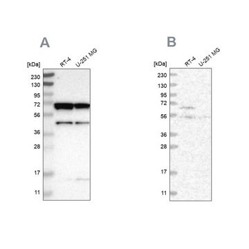 Anti-CROT antibody produced in rabbit Prestige Antibodies&#174; Powered by Atlas Antibodies, affinity isolated antibody, buffered aqueous glycerol solution, Ab3