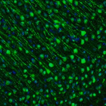 Anti-GMFB antibody produced in rabbit Prestige Antibodies&#174; Powered by Atlas Antibodies, affinity isolated antibody, buffered aqueous glycerol solution